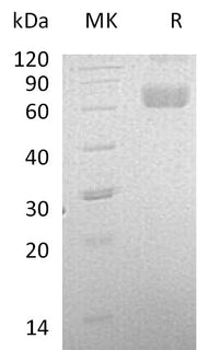 Recombinant Human LCAT (C-6His)