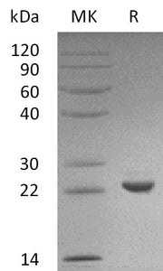 Recombinant Human SOD2 (C-6His)