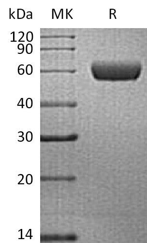 Recombinant Human PDPN (C-Fc)