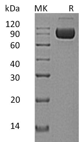 Recombinant Human IL-1RAcP (Q9NPH3-2, C-Fc-6His)