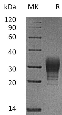 Recombinant Human CREG (C-6His)