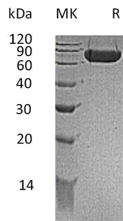 Recombinant Mouse Kirrel1 (C-6His)