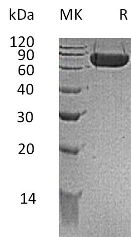Recombinant Mouse Kirrel1 (C-6His)