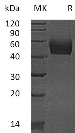 Recombinant Mouse Lumican (C-6His)
