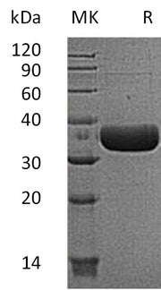 Recombinant Mouse Tpsb2 (C-6His)