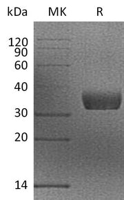 Recombinant Mouse Mgl2 (N-6His)