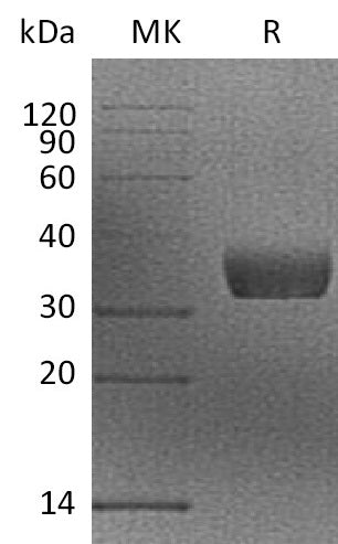 Recombinant Mouse Mgl2 (N-6His)