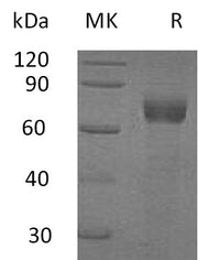 Recombinant Human IL-20RA (C-Fc)