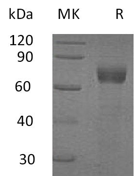 Recombinant Human IL-20RA (C-Fc)