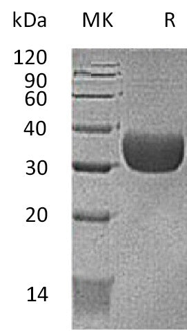 Biotinylated Mouse CXADR (C-Avi-6His)