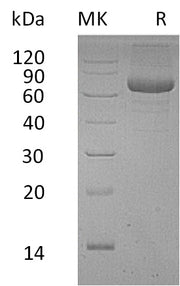 Recombinant Human PSG9 (C-6His)