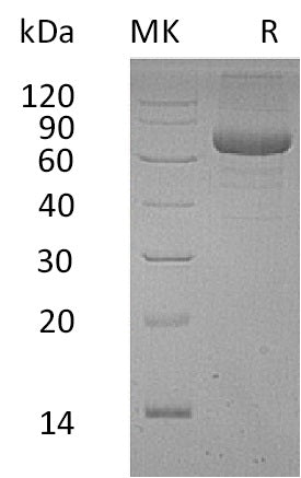 Recombinant Human PSG9 (C-6His)