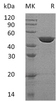 Recombinant Human GALK2 (C-6His)
