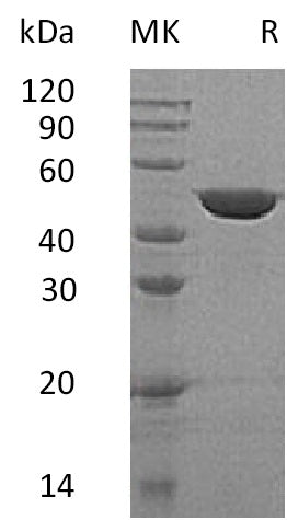 Recombinant Human GALK2 (C-6His)