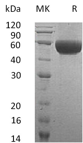Recombinant Human NTRI (C-6His)