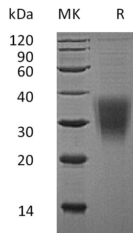 Recombinant Human NKG2A (N-8His)