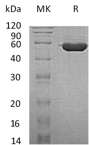 Recombinant Human TINAGL1 (C-6His)