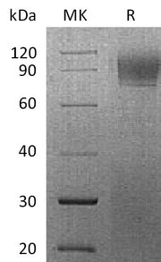 Recombinant Rhesus Macaque IFNAR1 (C-6His)