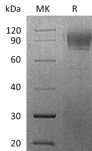 Recombinant Rhesus Macaque IFNAR1 (C-6His)
