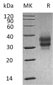 Recombinant Mouse FOLR1 (C-6His)