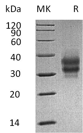 Recombinant Mouse FOLR1 (C-6His)