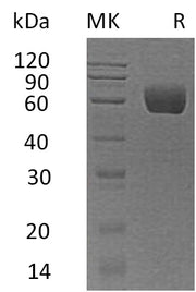 Recombinant Human Serpin A8 (C-6His)