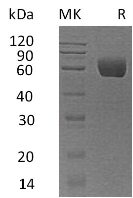 Recombinant Human Serpin A8 (C-6His)