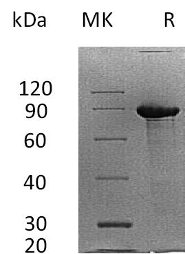 Recombinant Human SDC1 (C-Fc)