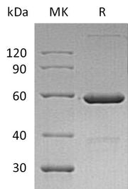 Recombinant Human VSIG8 (C-Fc)