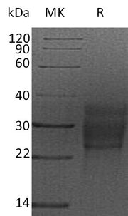 Recombinant Rat SCF (C-6His)