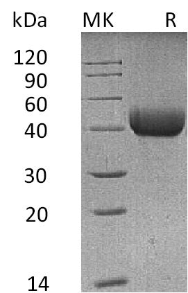 Recombinant Mouse SP-D (C-6His)