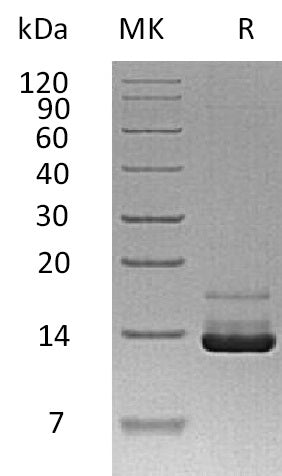 Recombinant Human PTH (N-8His)