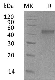 Recombinant Mouse ST6GalNAc2 (C-6His)