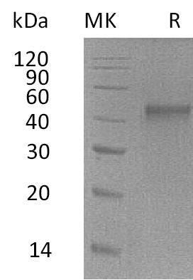 Recombinant Mouse ST6GalNAc2 (C-6His)