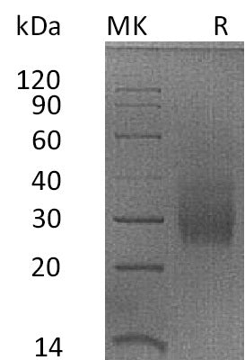 Recombinant Rhesus Macaque HVEM (C-6His)