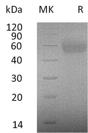 Recombinant Human IL-2RG (C-6His)