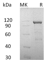 Recombinant Human CDH11 (C-Fc-6His)