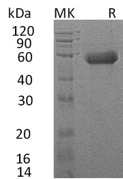 Recombinant Human IL-18RAcP (C-6His)