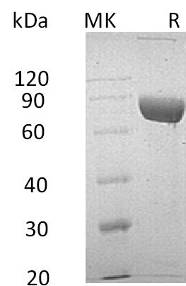 Recombinant Human LRG1 (C-Fc-6His)