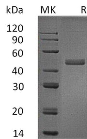 Recombinant Human IL-17B (C-Fc)