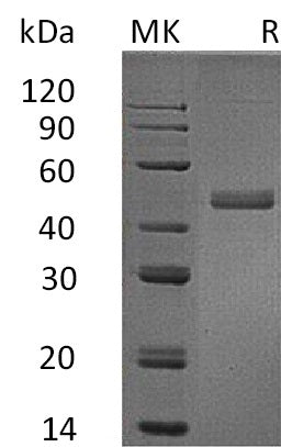 Recombinant Human IL-17B (C-Fc)