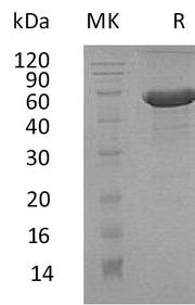 Recombinant Human DPT (C-Fc-6His)