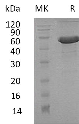 Recombinant Human DPT (C-Fc-6His)