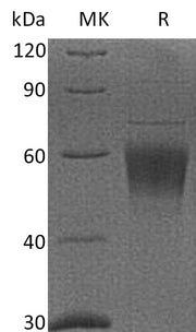 Recombinant Cynomolgus CRTAM (C-6His)