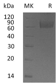 Recombinant Human IL-18BPa (C-Fc)
