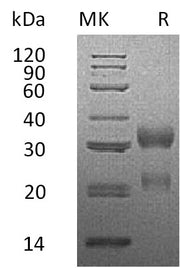 Recombinant Human CGA&CGB3 (C-Flag, C-6His)