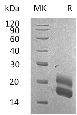 Recombinant Rat GM-CSF (C-6His)