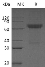 Recombinant Human CD16b (C-Fc)