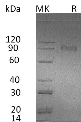 Recombinant Human AMIGO2 (C-Fc)
