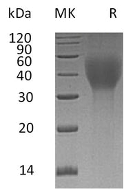 Recombinant Human TCblR (C-6His)